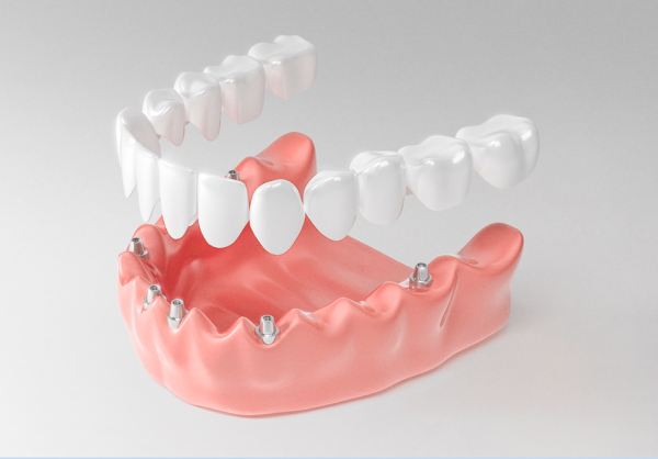 Myths about dentures