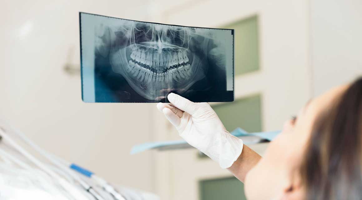 Is it safe to take dental x-rays