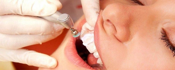 Hypersensitivity of the teeth - causes and treatment