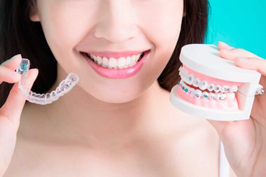 Eleperers against braces. What is the difference