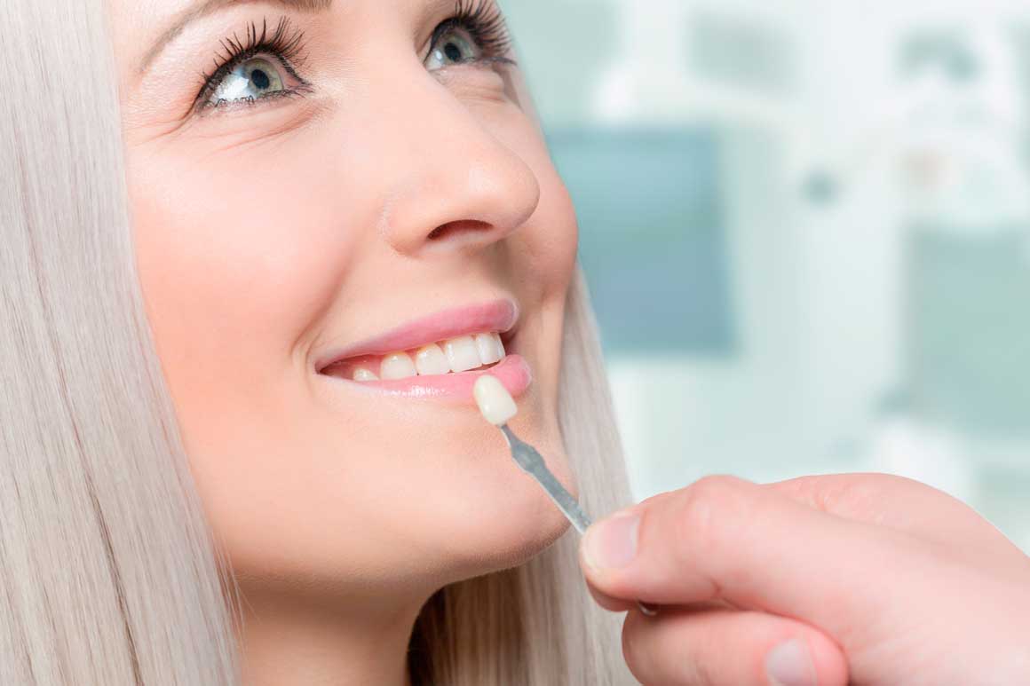 Do teeth deteriorate under veneers
