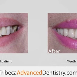 Tribeca Advanced Dentistry - Olga Malkin, DMD