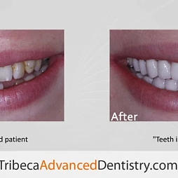 Tribeca Advanced Dentistry - Olga Malkin, DMD
