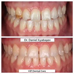 VIP Dental Care